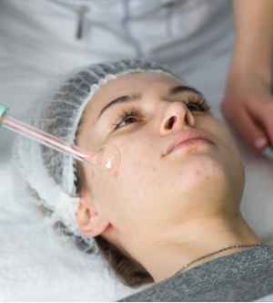 Active Acne Treatment Program