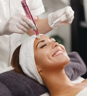 PRP with Microneedling