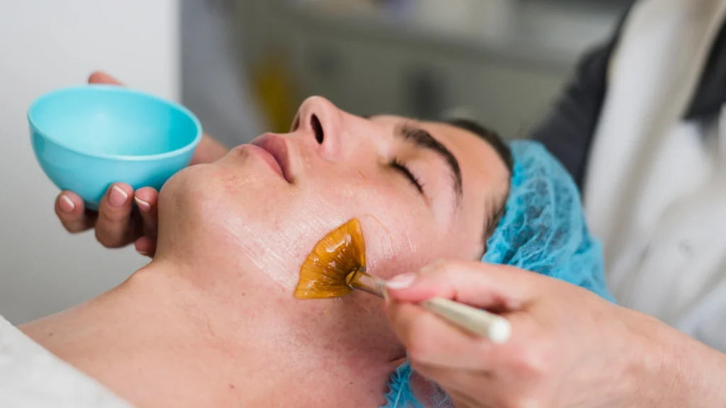 Acnelan combined with other dermatology treatments for skin management.