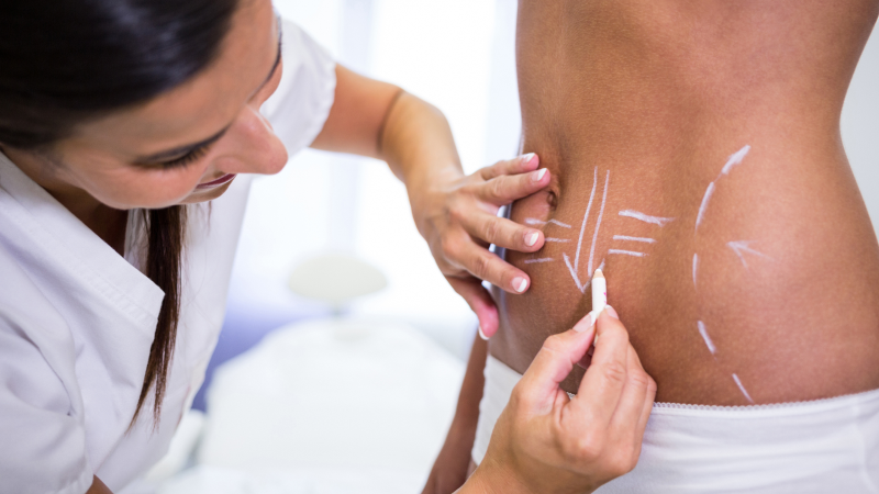 How many body contouring sessions need and body contouring toronto cost information.
