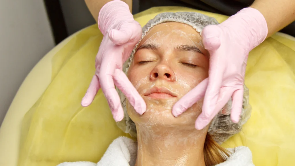 Learn about the acnelan peel procedure for acne-prone skin treatment.