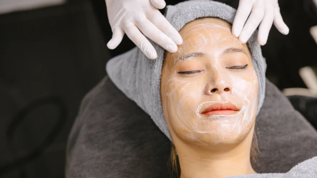 Active acid layering and intensification as part of the acnelan procedure.