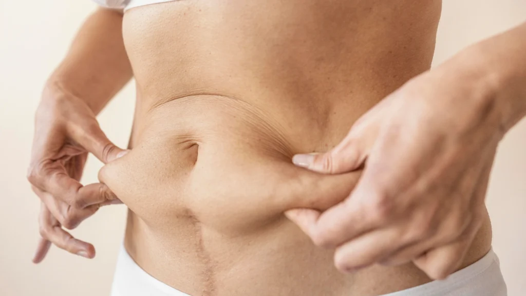 Adipose lipolysis fat breakdown with lipolysis treatments supporting metabolic process. 