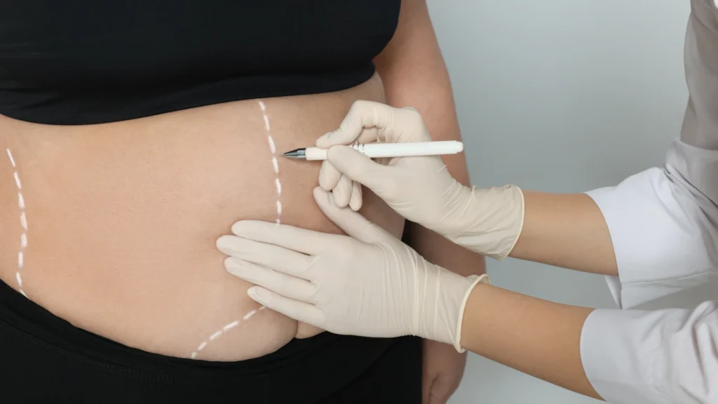 Enzyme lipolysis supports the process of fat breakdown through regulated metabolic signaling. 