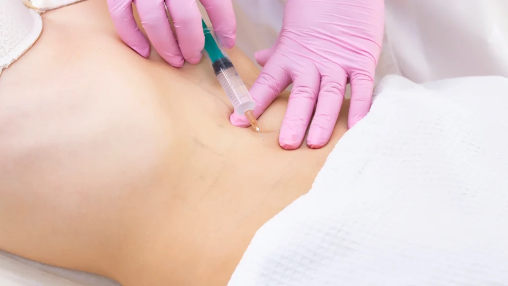 Hormone-sensitive lipase is one of the key lipolysis enzymes involved in stored fat breakdown. 