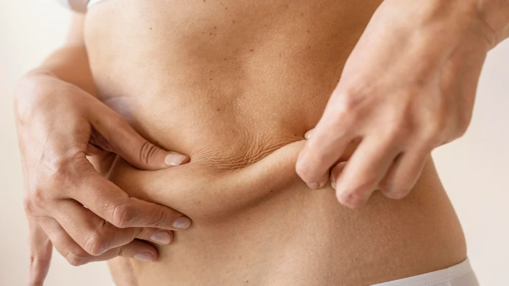 MGL completes fat breakdown through the action of lipolysis enzymes. 