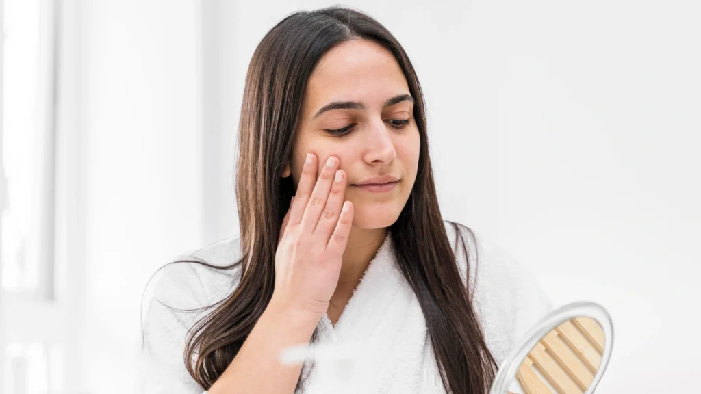 Peeling and skin renewal phase after the acnelan peel procedure.