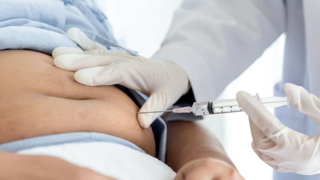 Learn what to expect after a lipolysis procedure.