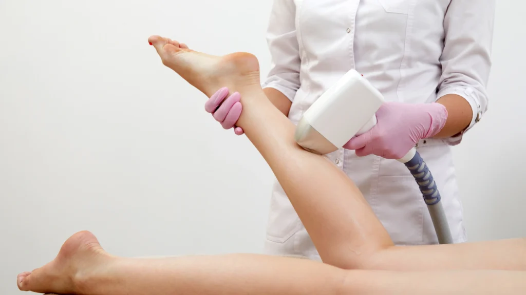 Best laser hair removal in Toronto for Asian skin. 