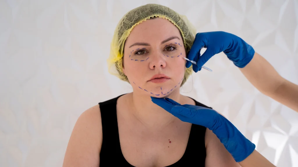 Know what is buccal fat removal and buccal fat removal price Toronto.