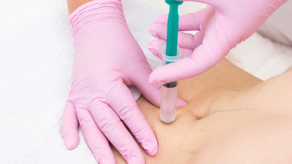 Learn what lipolysis is, how lipolysis and gluconeogenesis work together. 